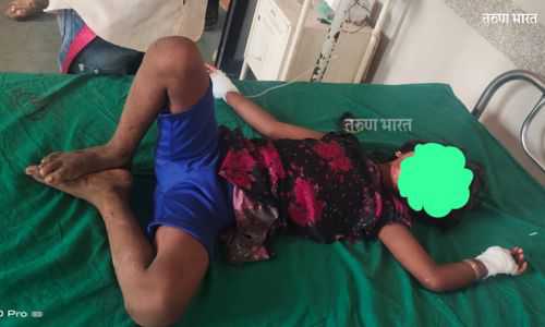 Ratnagiri : मोबाईलच्या बॅटरीचा स्फोट झाल्याने महाडमध्ये चिमुरडी गंभीर जखमी