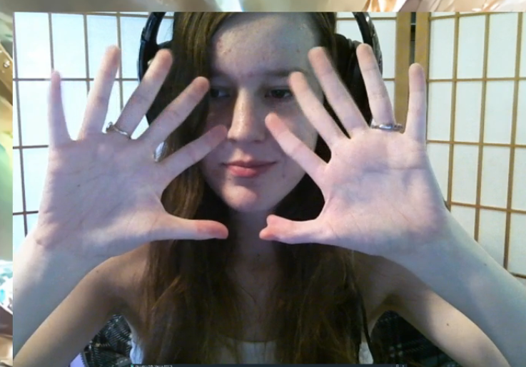 दोन्ही हातांमध्ये 6 बोटं असणारी युवती