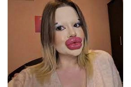 स्वत:च्या ओठांमुळे प्रसिद्ध महिला