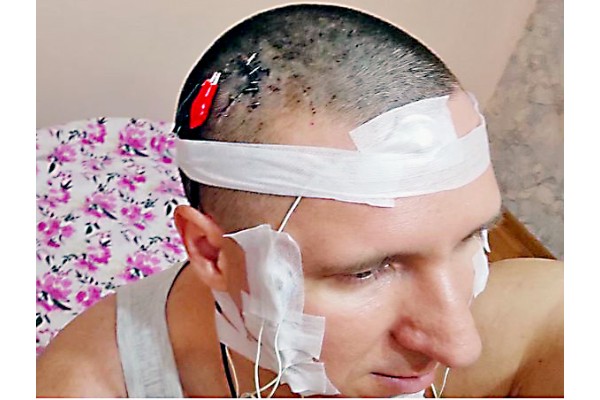 He performed the surgery on his own brain