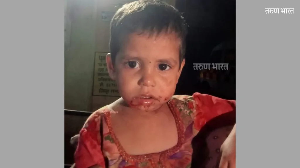 पिसाळलेल्या कोल्ह्याचा एका बालिकेसह सहा जणांवर हल्ला girl were attacked crushed fox