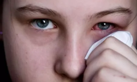 I spread the flu, so take care of your eyes