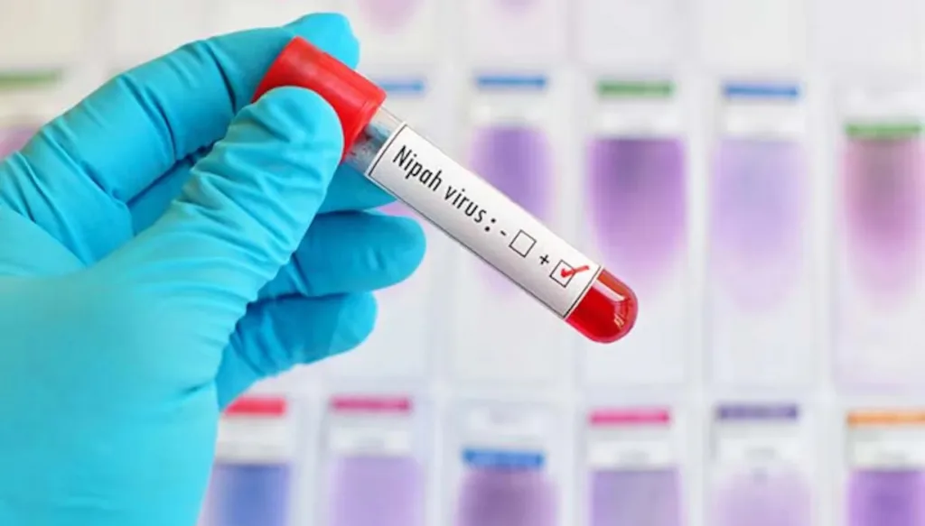 Caution from health department in the background of Nipah virus