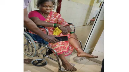 भटक्या कुत्र्याचा चावा । वेत्ये येथील महिला जखमी