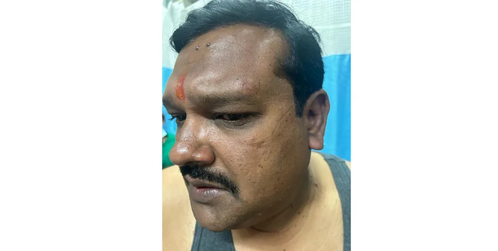 भाग्यनगर येथे नगरसेवकावर रॉडने हल्ला A corporator was attacked with a rod in Bhagyanagar