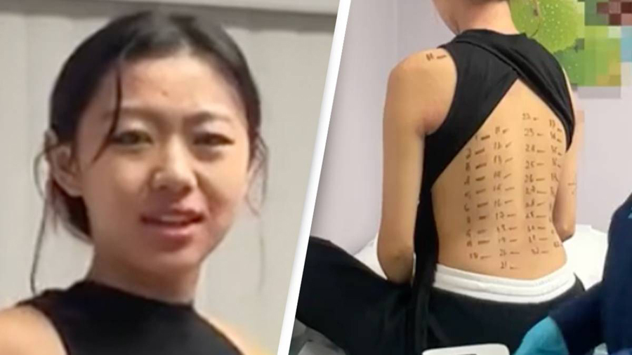 The girl is allergic to everything