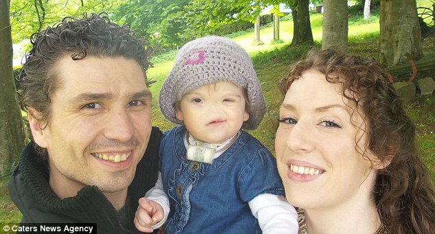 The story of a girl born without a nose went viral