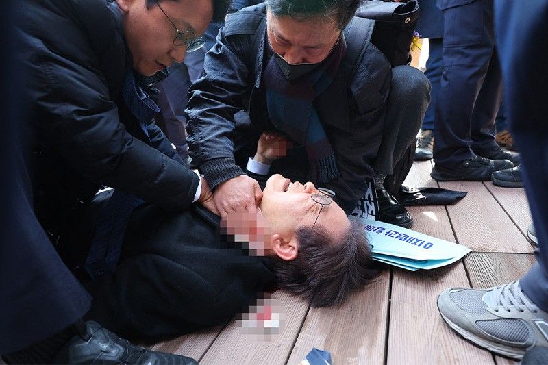 Attack on opposition leader in South Korea arrested by police