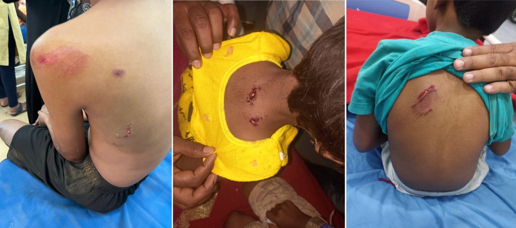 Haidos of stray dogs in Mahanteshnagar area