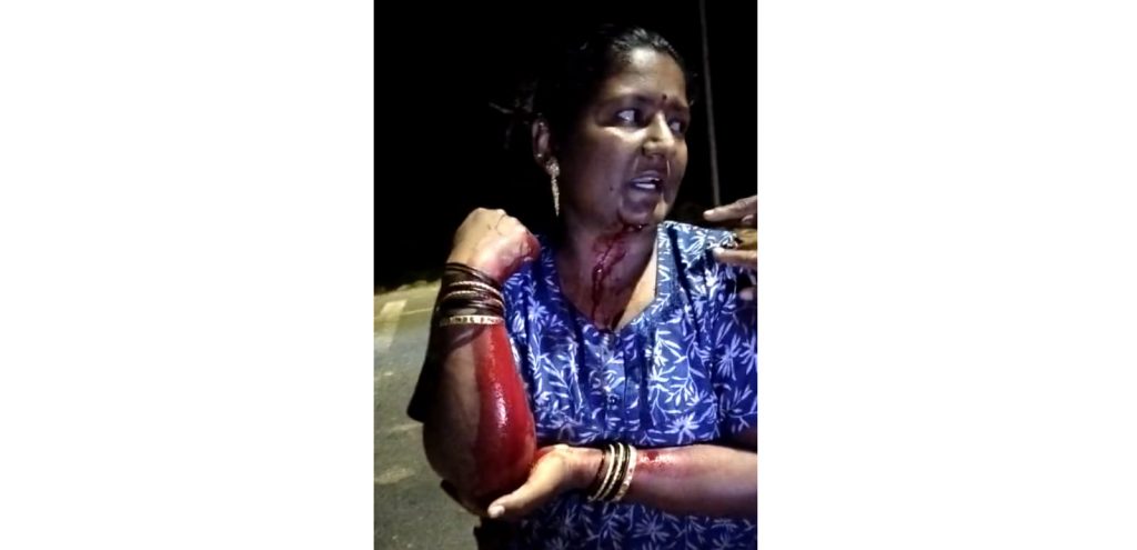 A woman who went for a morning walk was attacked with a knife and robbed of her jewellery