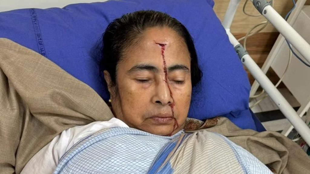 ममता बॅनर्जी यांच्या डोक्याला दुखापत Mamata Banerjee's head injured