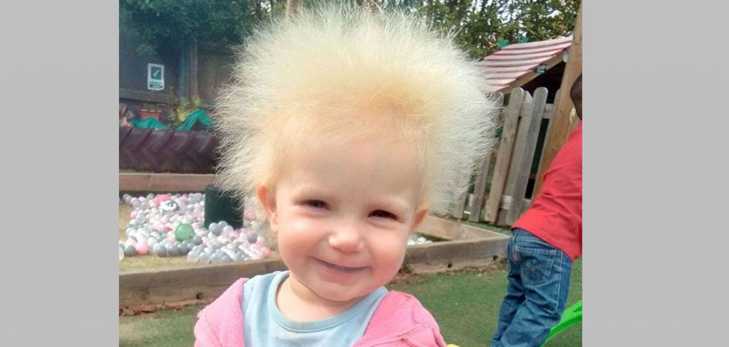 अत्यंत विचित्र केस असणारी चिमुकली A little girl with very strange hair