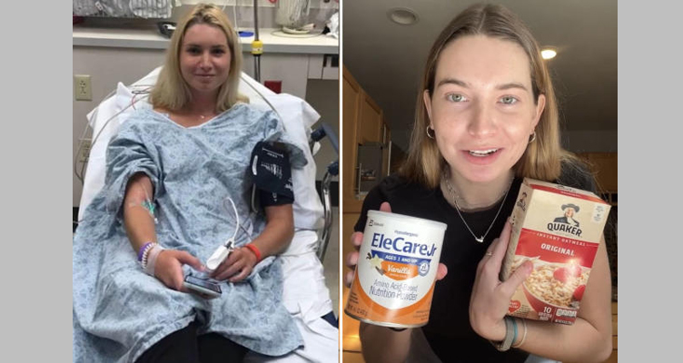 A girl with food allergy