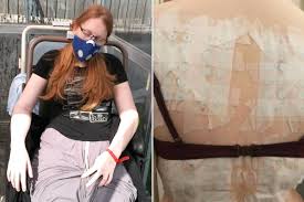 काही न खाऊ शकणारी युवती A girl who cannot eat anything